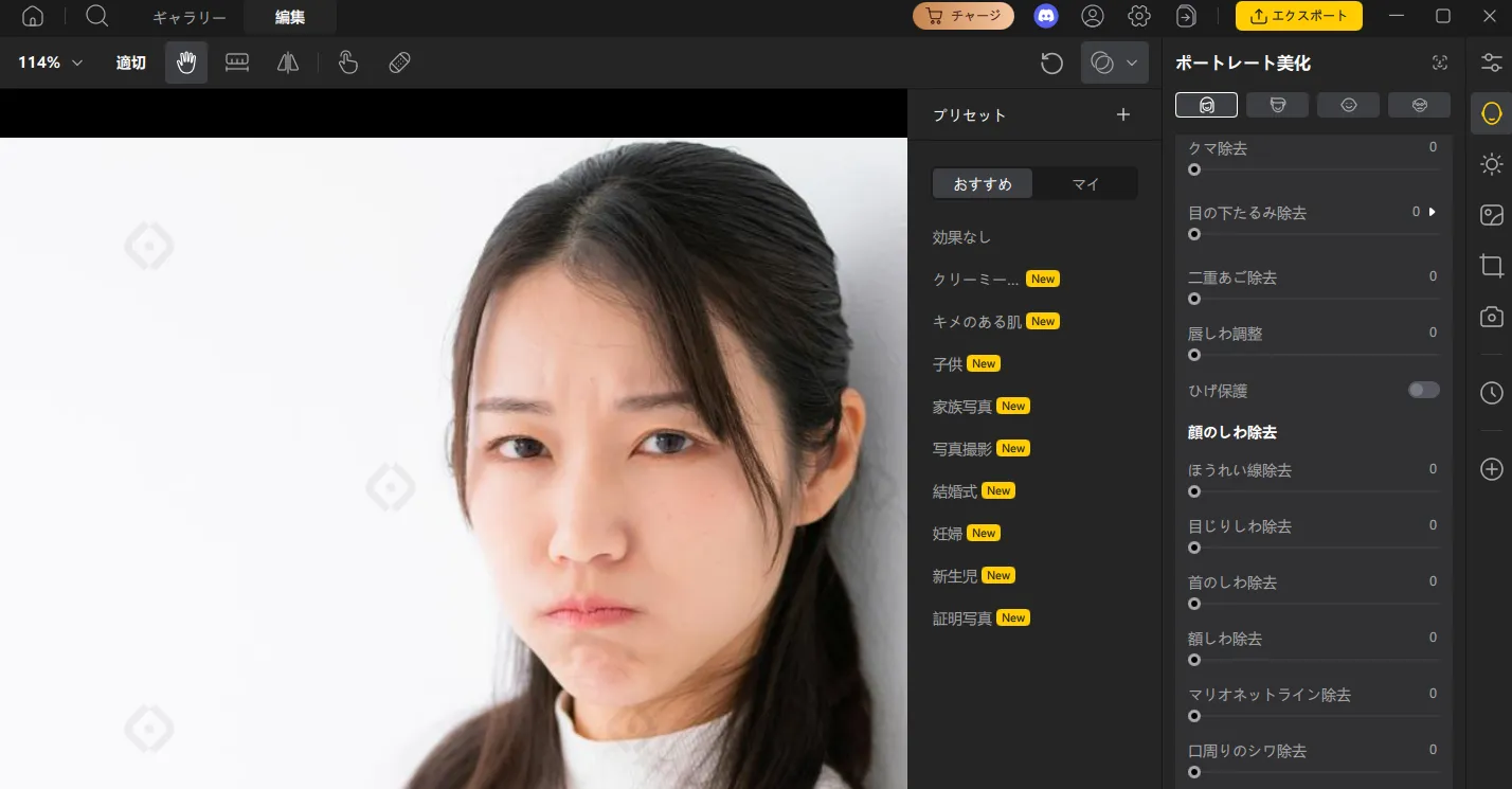 ほうれい線除去前