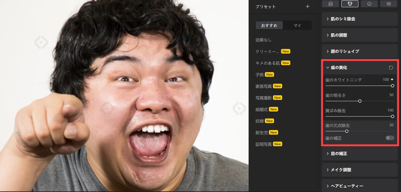 歯の美化前