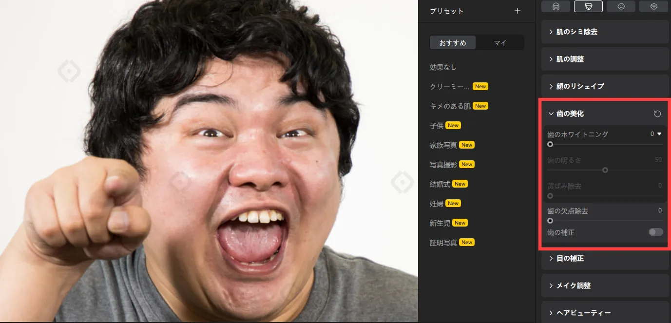 歯の美化後